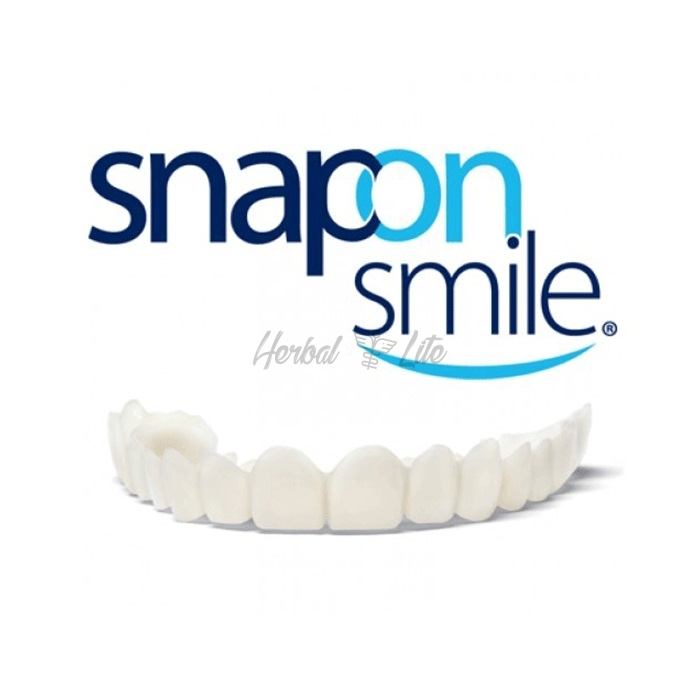 Snap-On Smile di Chiteureup